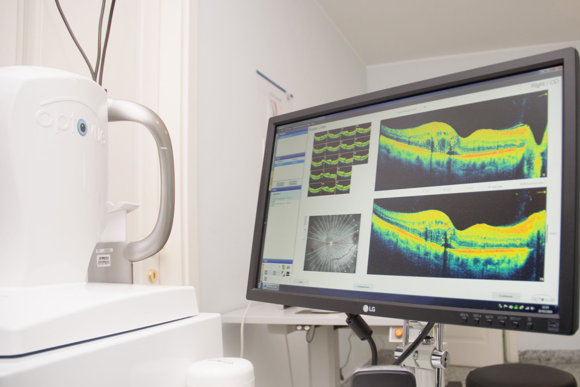 Tomografia ottica computerizzata  (OCT) - Angio-OCT